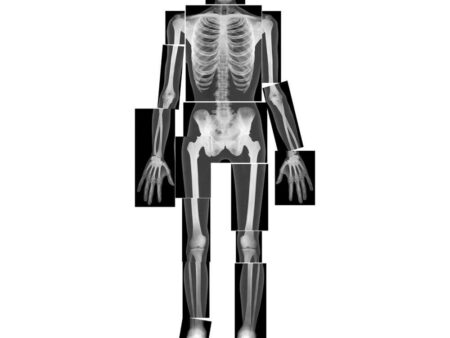 True-to-life Human X-rays-EYR - Image 1