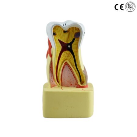 School Stationery Supplies Biology : Diseased Tooth Model - Image 1