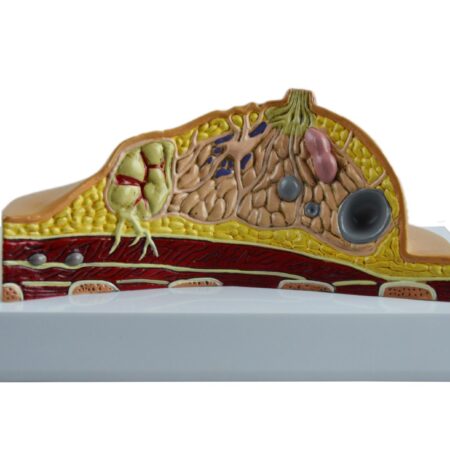 Biology : Diseased Breast Model - Image 1